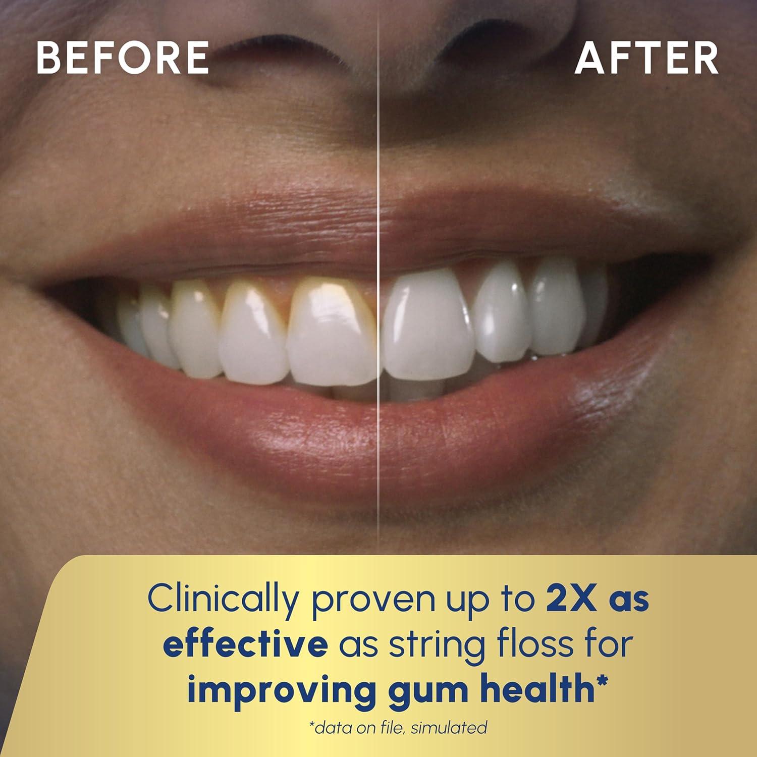 The Waterpik Cordless Advanced 2.0: Why We Think It's the Best Water Flosser for Healthy Gums!